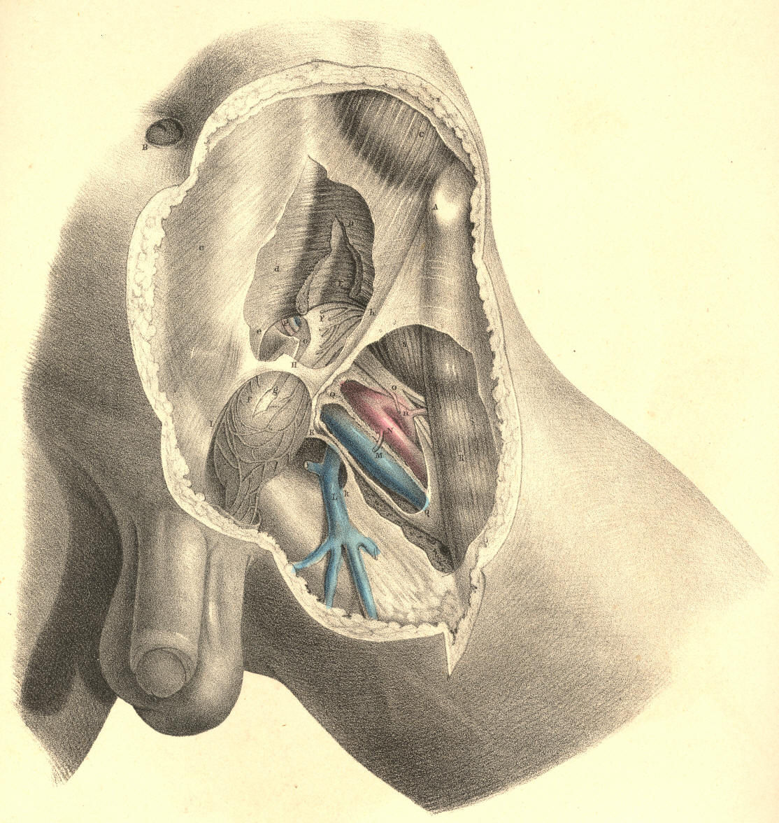 Neck Hernia