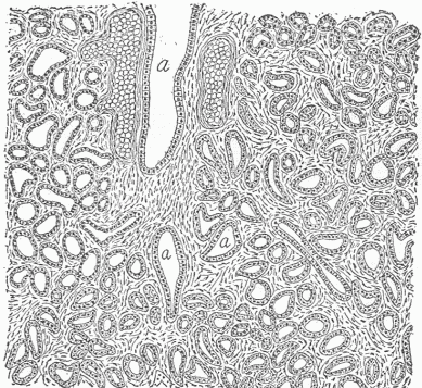 Fig. 5—A Section Of The Mammary Gland. (a) The ducts of the gland, by which the milk secreted by the cells which line all the small openings, is conveyed to the nipple. All these openings are continuous with the surface of the skin. On each side of the large ducts is a vein filled with blood corpuscles.