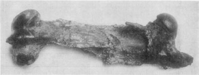 Fig. 47—Same bone as in Fig. 46 after about six months' treatment. In this case Dr. Merillat employed a weight to counteract muscular contraction. It is noticeable that very little provisional callus has formed in this case, and in spite of unusual ingenuity and good facilities for caring for the subject, union of bone did not occur.