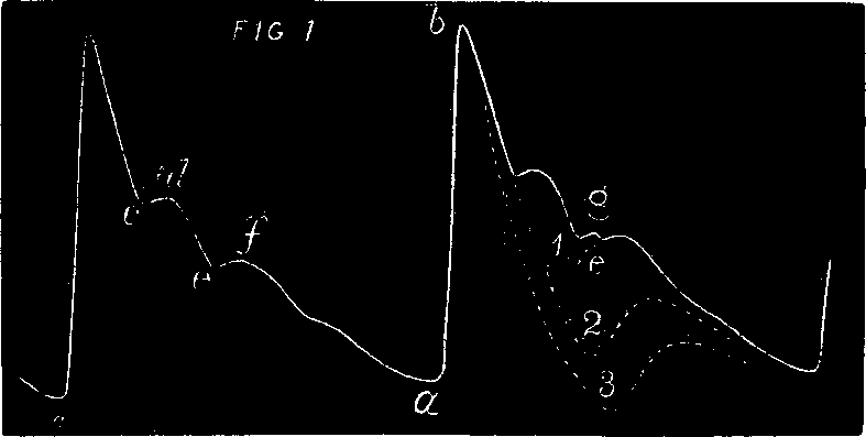 Illustration: Fig. 2. The above is a representation of a tracing of a healthy pulse as made with the Sphygmograph.