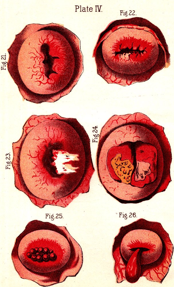 Illustration: Fig. 22. Fig. 21. Fig. 23. Fig. 24. Fig. 25. Fig. 26.