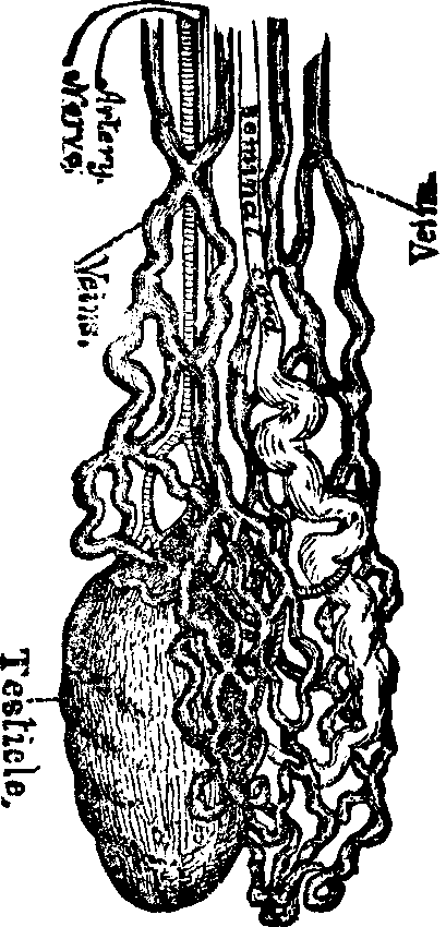 Illustration: Fig. 2. A Testicle wasted by Masturbation.