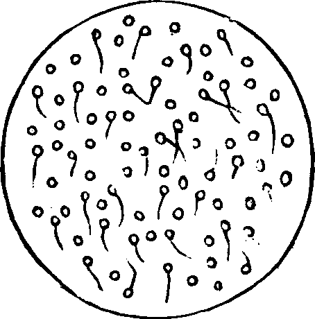 Illustration: Fig. 4. Microscopic appearance of semen which will not fecundate.