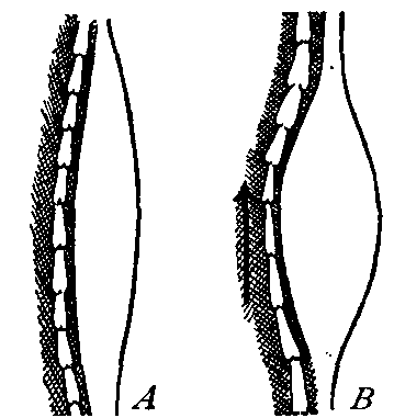 Fig. 29