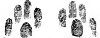 FINGER-PRINTS OF TWINS