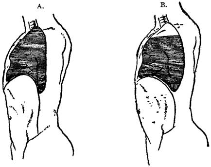 Fig. 14