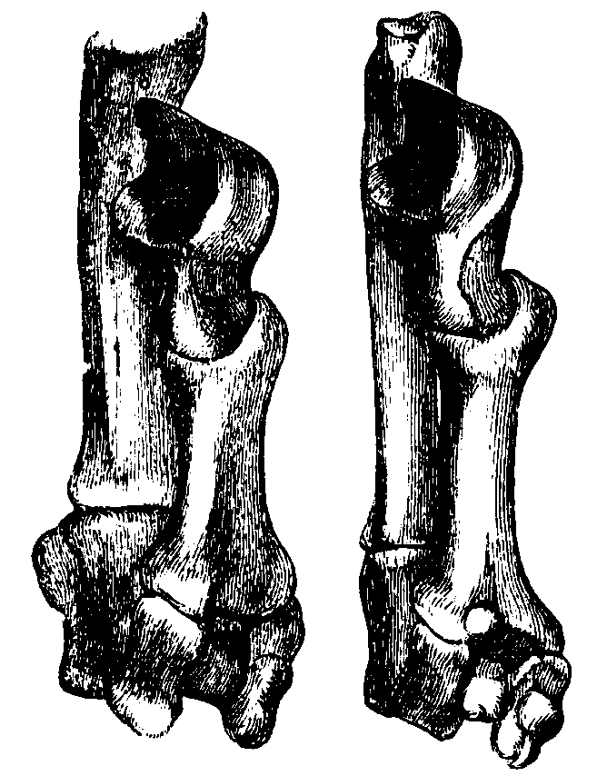 Tarsal bones of different Lemuroids.