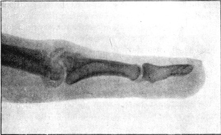 Fig. 59.