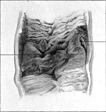 Fig. 88.