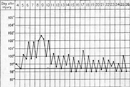 Temperature Chart 1.