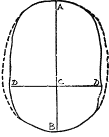 Outline narrower than Figure 1.