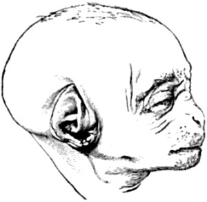 Fœtus of an Orang.