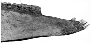 Side view of lower jaw bone.