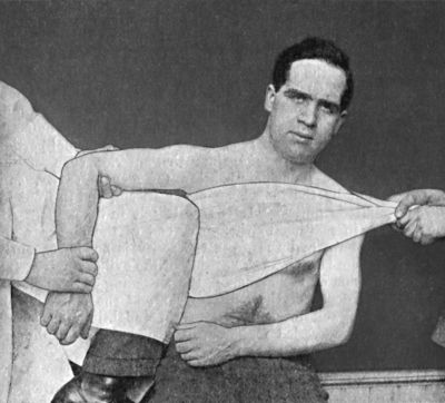 Fig. 24.—Miller's Method of reducing Sub-coracoid Dislocation—Second Movement.