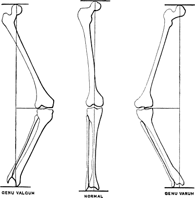 Fig. 135.