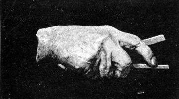 SIR E. BOEHM'S HAND.