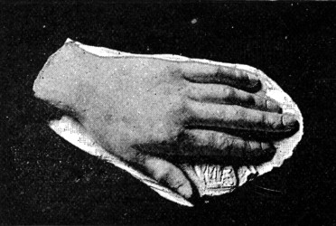 MRS. THORNYCROFT'S HAND.