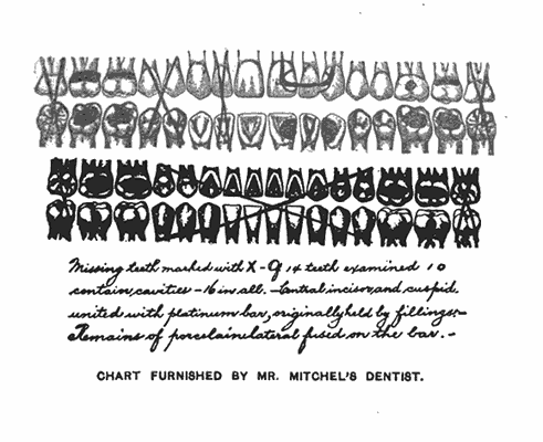 Missing teeth marked with X—Of 14 teeth examined 10 contain cavities—16 in all.—Central incisor and cuspid united with platinum bar, originally held by fillings.— Remains of porcelain material fused on the bar.  CHART FURNISHED BY MR. MITCHEL'S DENTIST.