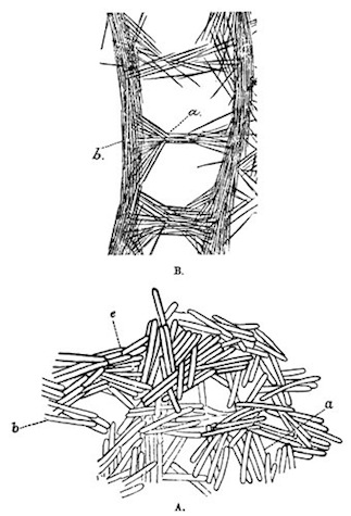 Illustration: Radial sections of fragments of the skeletons of Spongillæ
