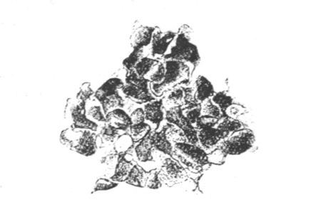 Illustration: Fig. 31.—Part of the zoarium of Victorella bengalensis entirely transformed into resting buds, × 25. (From an aquarium in Calcutta.)
