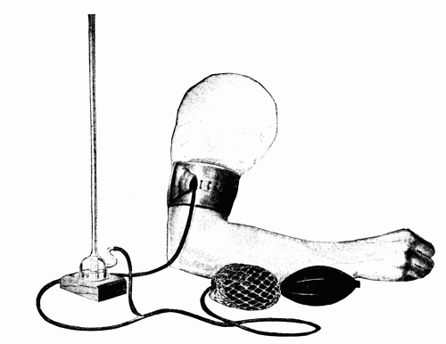 Fig. 13.—Cook's modification of Riva-Rocci's blood pressure instrument.