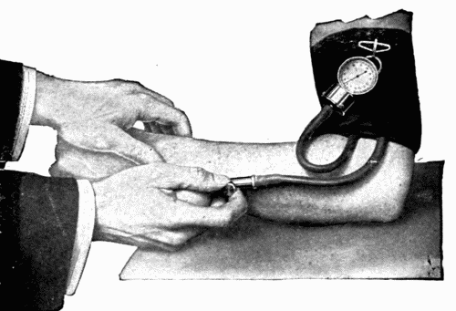 Fig. 18.—Rogers' "Tycos" dial sphygmomanometer.