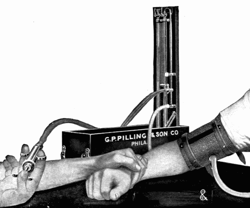 Fig. 23.—Method of taking blood pressure with a patient in sitting position.