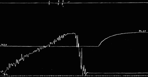 Fig. 30.—Figures are to be read from left to right. The top line records the points where sounds were heard, the figures above the short vertical lines refer to tones (see text). Mx. B. P., maximum blood-pressure. M. B. P., minimum blood-pressure. P. B., pressure bulb recorder. It was impossible to lower and raise this bulb by hand without obtaining the great irregular oscillations of the attached lever above the mercury manometer. B. L., base line.