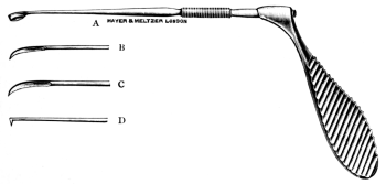 Burkhardt-Merian’s Aural Instrument