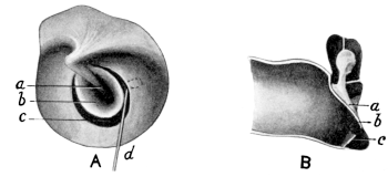 Free Edge of Tympanic Membrane cut through