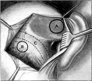 Topography of the Auditory Region of the Skull