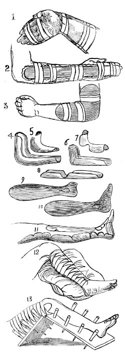 splints 1-13