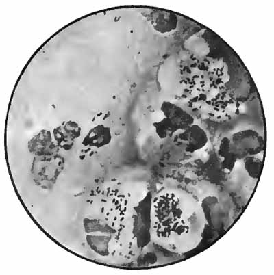 Bacillus of influenza