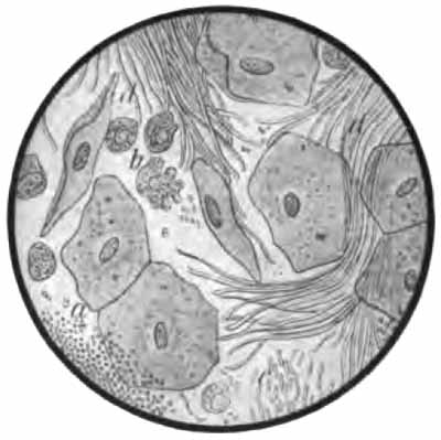 Gingival deposit