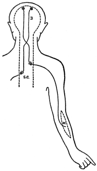 DIAGRAM OF MOTOR PATHWAY  B, brain; S. C., spinal cord; M, muscle