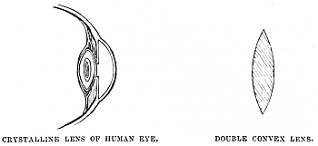 Image unavailable: CRYSTALLINE LENS OF HUMAN EYE. DOUBLE CONVEX LENS.