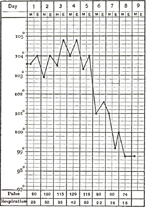 A Typical Case of Lobar Pneumonia in the Adult: Recovery by Crisis