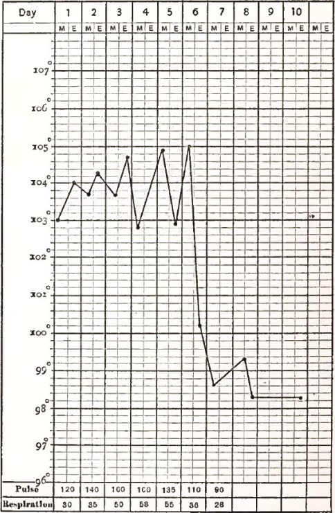 A Typical Case of Lobar Pneumonia in a Child: Recovery