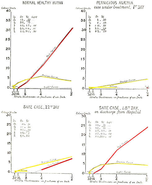 Normal Healthy Human. Pernicious Anaemia. Same Case 22nd day. Same Case 48th day