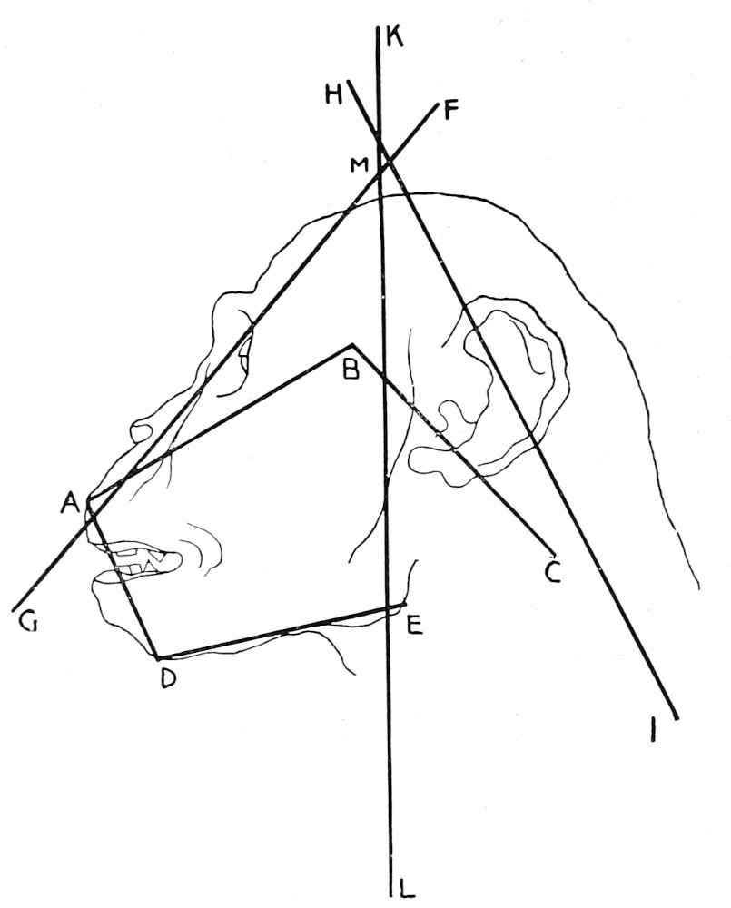 Diagram No. 2