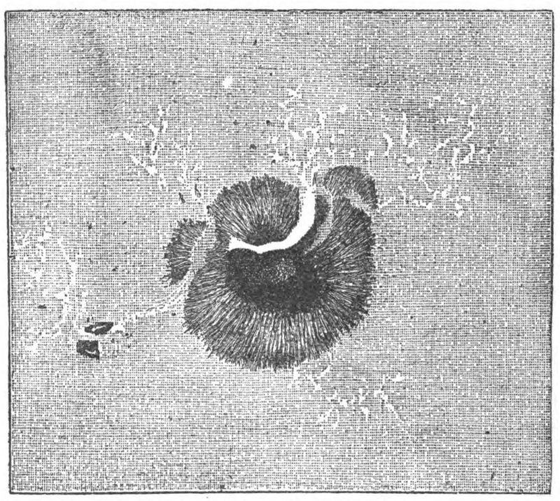 Drawing of a sun spot