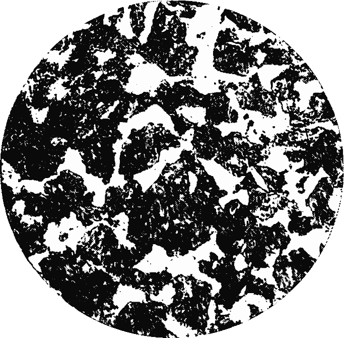 The magnified cross-section of a hypo-eutectoid                 steel bar with a high carbon content shows a                 conglomerate of dark pearlite particles.                 The interstices are filled with a light-colored                 ferrite structure.