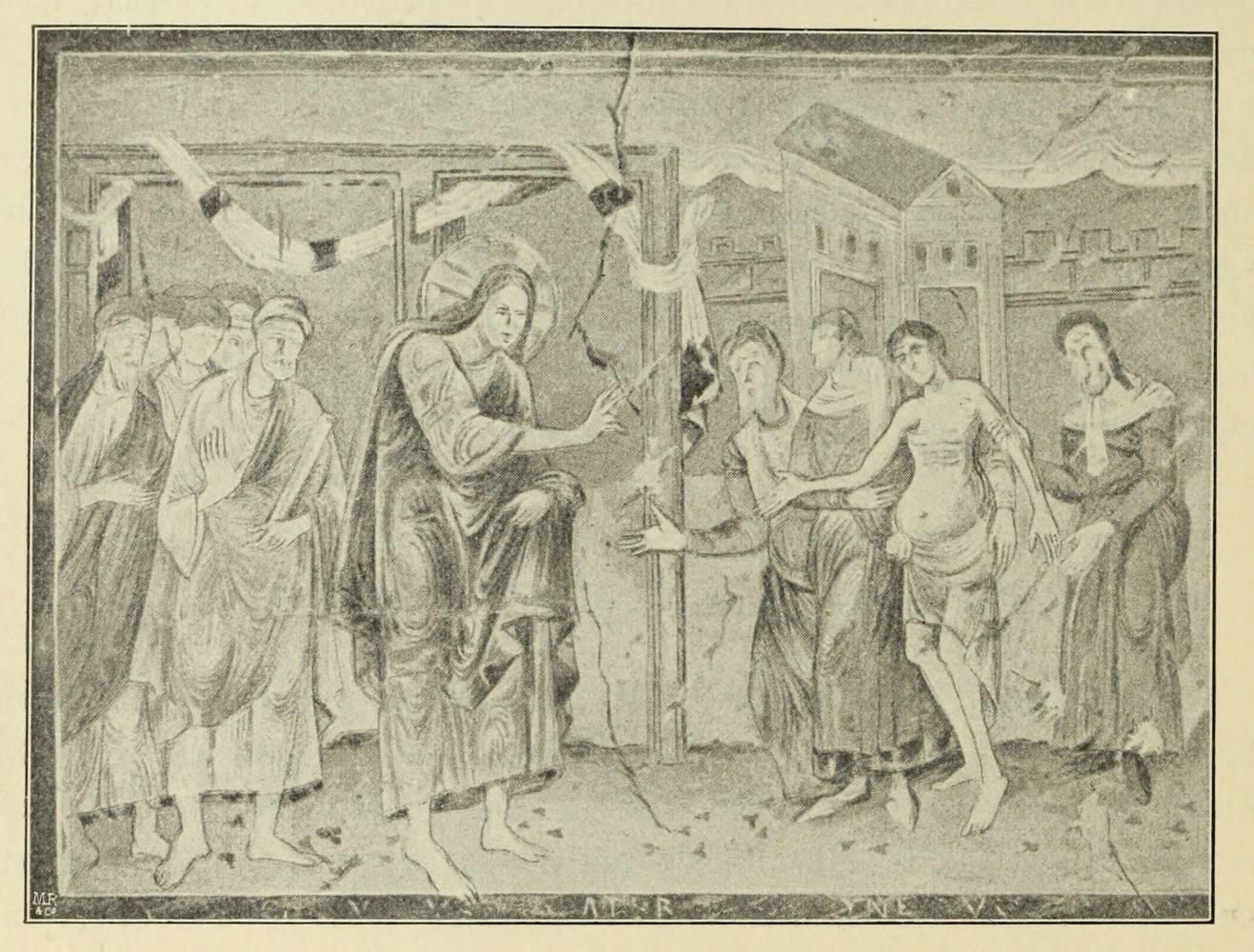 Heilung des Wassersüchtigen