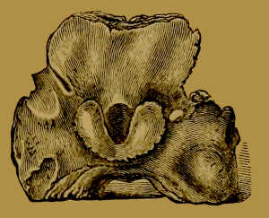 Back view of the same.