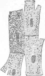 Fettmetamorphose von Herzmuskelzellen