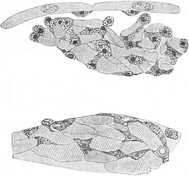 Muskelabbau durch Leukocyten