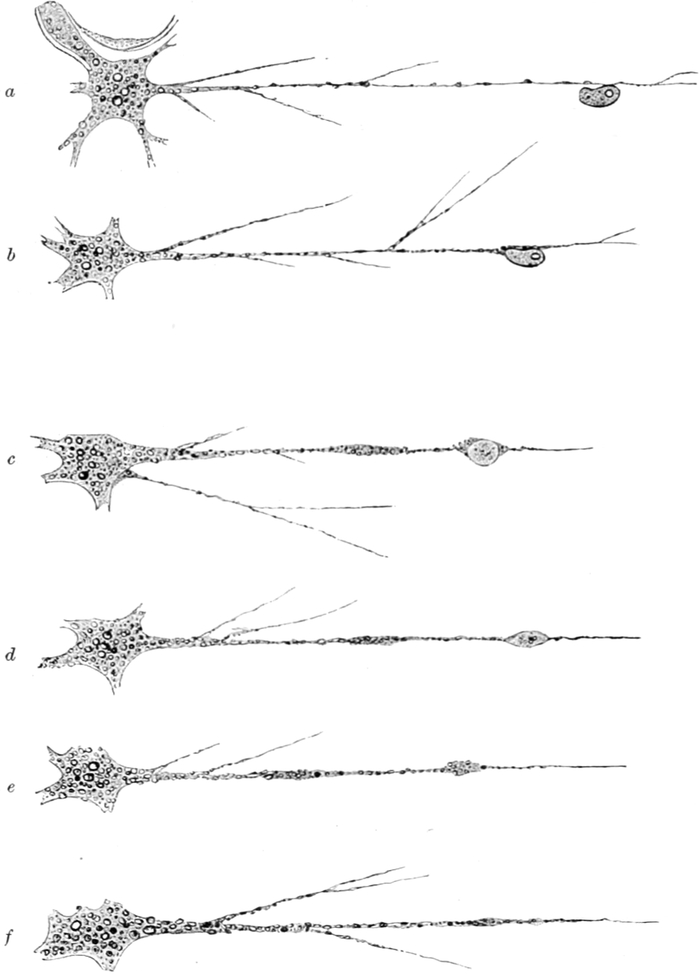 Pseudopodium mit gefangenem   Infusorium