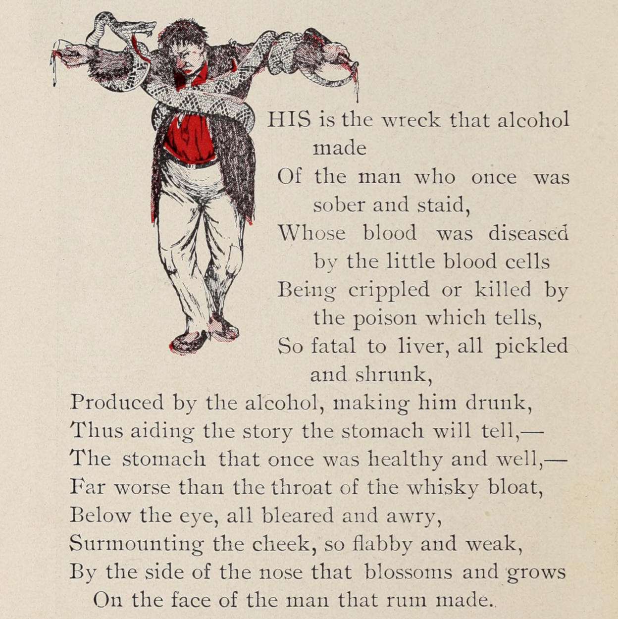 Drunkard tied to a capital T
