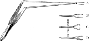 Sexton&rsquo;s Instrument