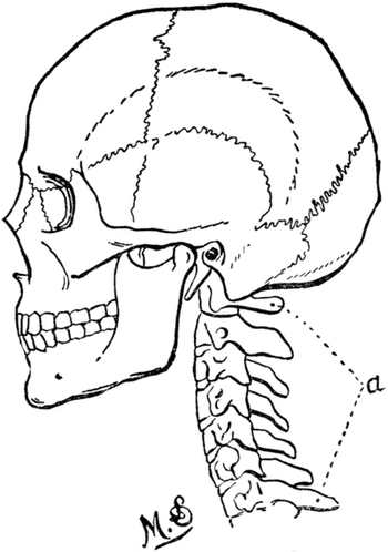 Skull of Man